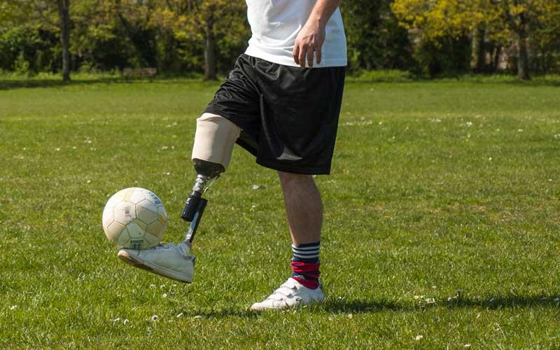 醫療器械加工：假肢CNC加工